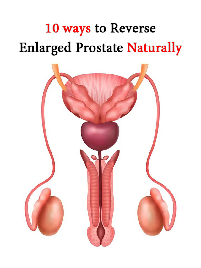10 Ways To Reverse Enlarged Prostate Naturally Te Mend 5808