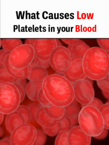 what-causes-low-platelets-in-your-blood