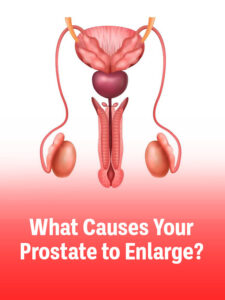 What-causes-your-prostate-to-enlarge