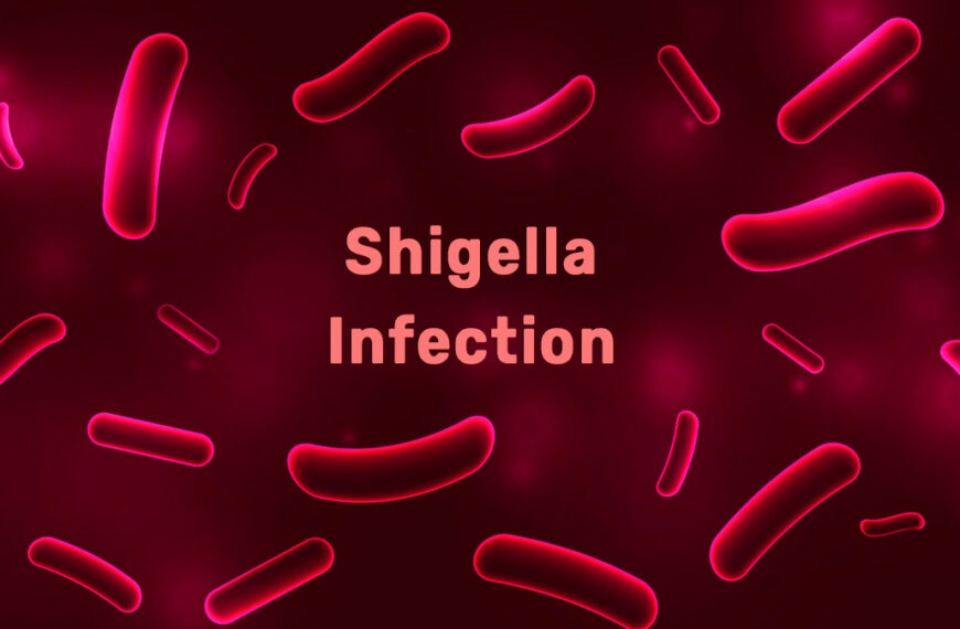 what-is-shigella