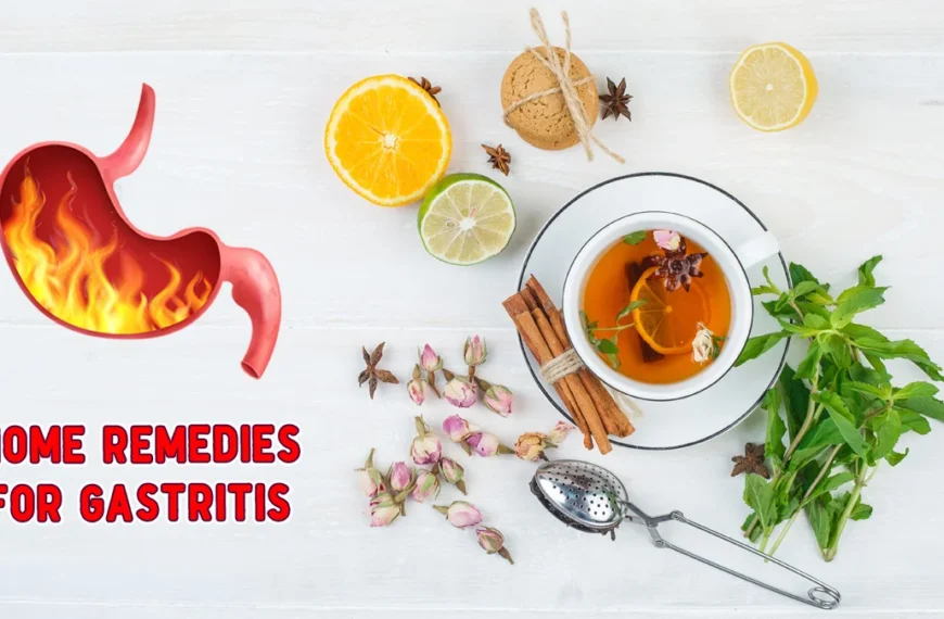 Home-Remedies-for-Gastritis